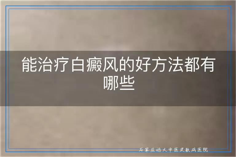 能治疗白癜风的好方法都有哪些