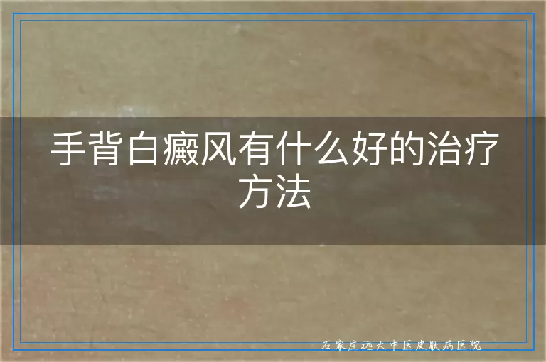 手背白癜风有什么好的治疗方法