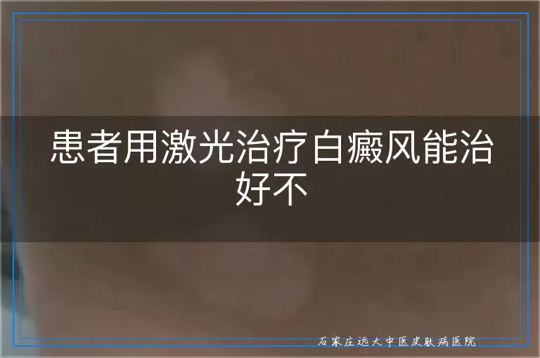 患者用激光治疗白癜风能治好不