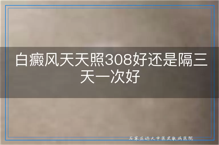 白癜风天天照308好还是隔三天一次好