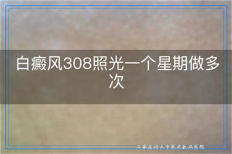 白癜风308照光一个星期做多次