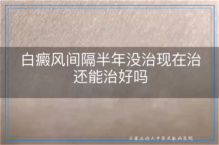 白癜风间隔半年没治现在治还能治好吗