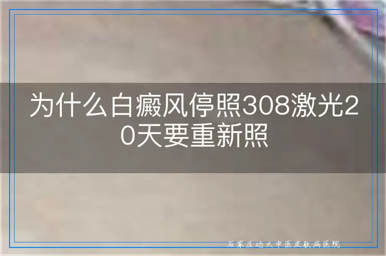 为什么白癜风停照308激光20天要重新照