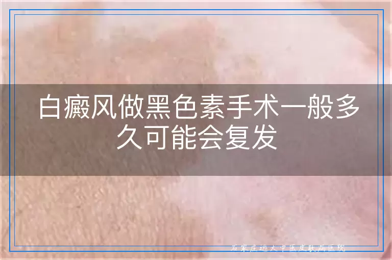 白癜风做黑色素手术一般多久可能会复发