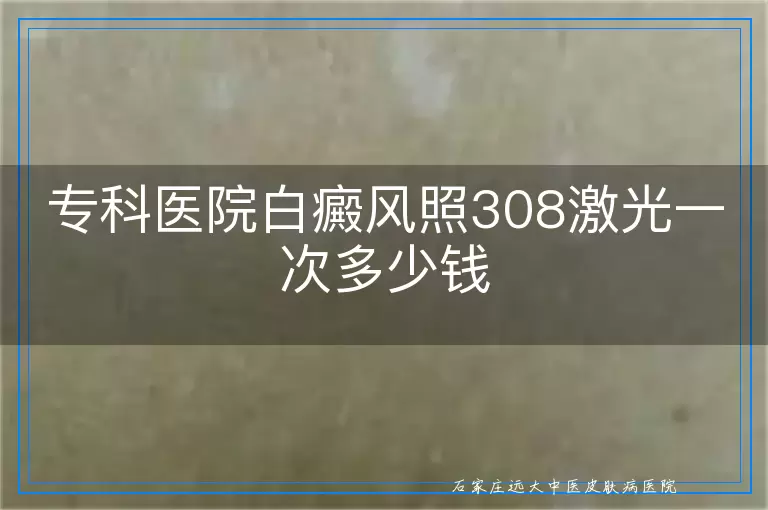 专科医院白癜风照308激光一次多少钱