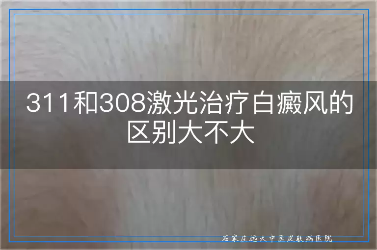 311和308激光治疗白癜风的区别大不大
