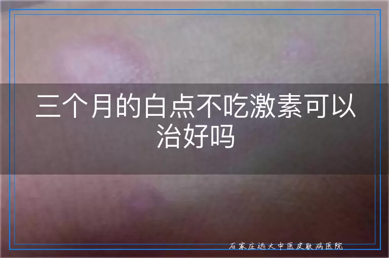三个月的白点不吃激素可以治好吗