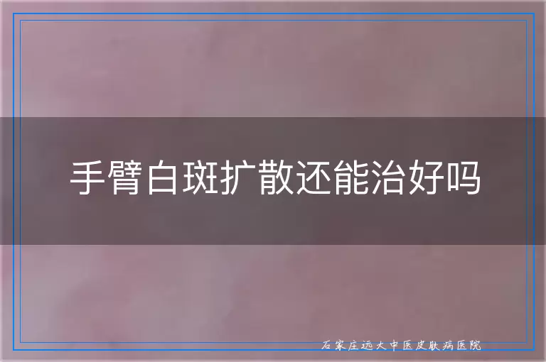 手臂白斑扩散还能治好吗