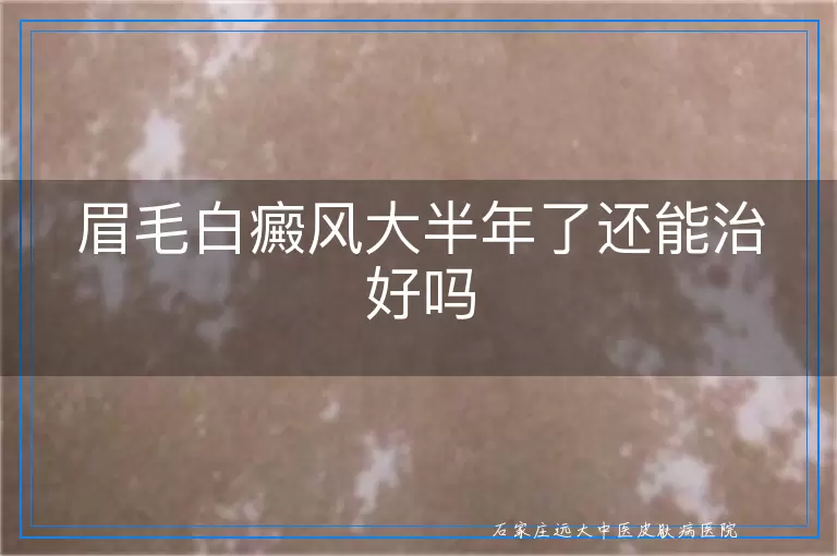 眉毛白癜风大半年了还能治好吗