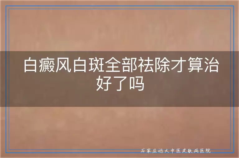 白癜风白斑全部祛除才算治好了吗