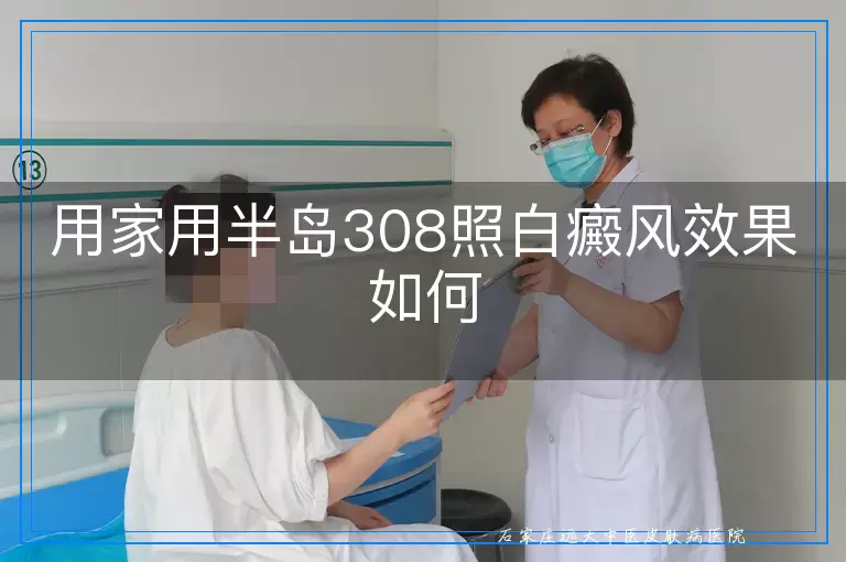 用家用半岛308照白癜风效果如何