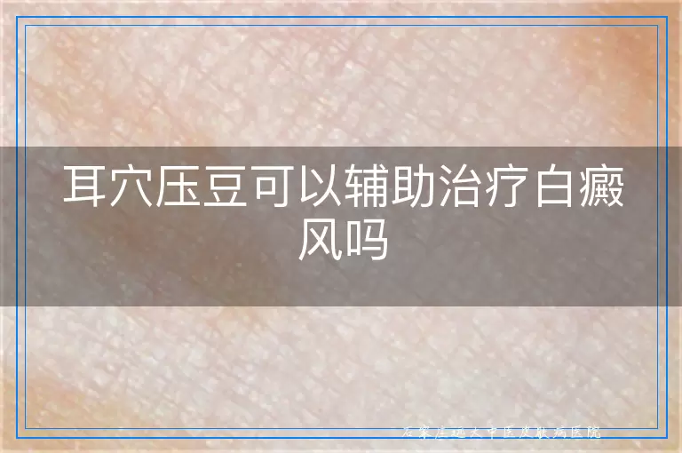 耳穴压豆可以辅助治疗白癜风吗