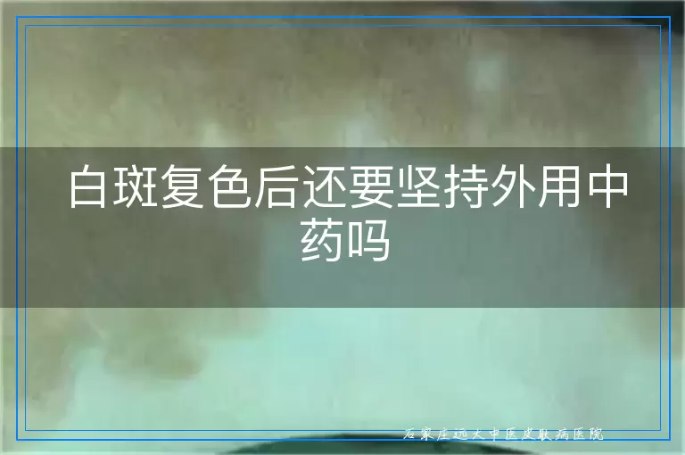 白斑复色后还要坚持外用中药吗