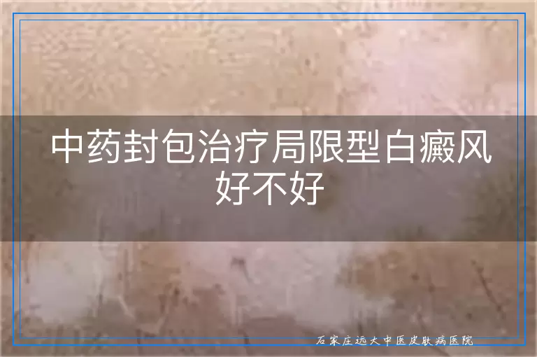 中药封包治疗局限型白癜风好不好