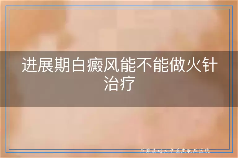 进展期白癜风能不能做火针治疗
