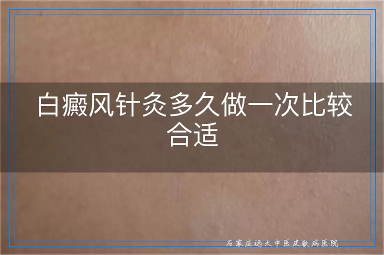 白癜风针灸多久做一次比较合适