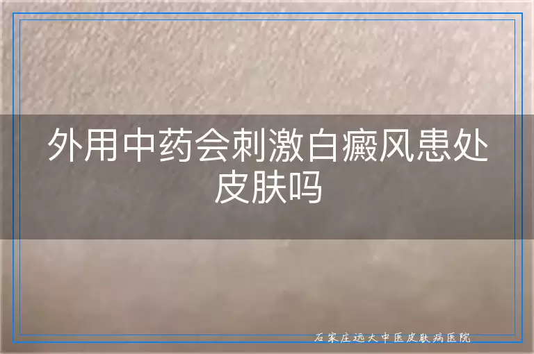 外用中药会刺激白癜风患处皮肤吗