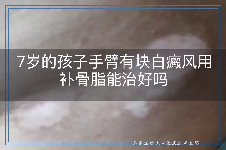 7岁的孩子手臂有块白癜风用补骨脂能治好吗