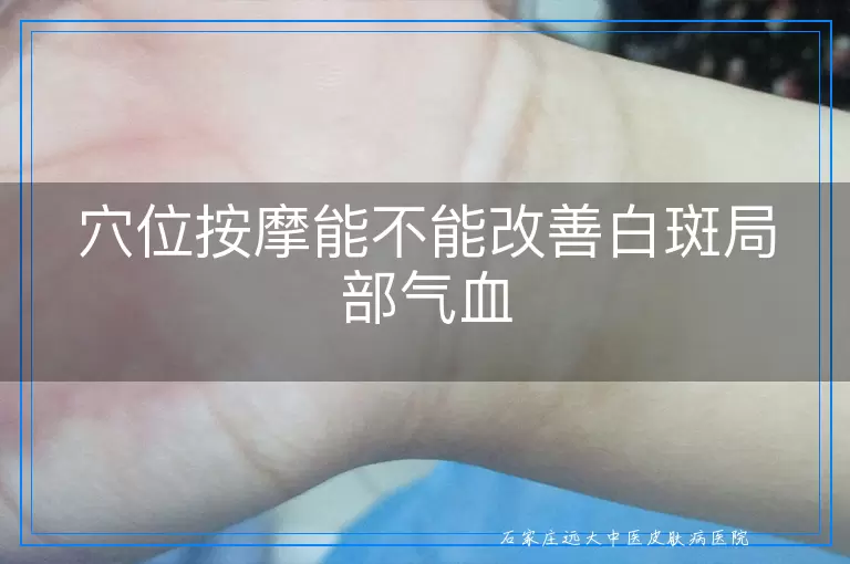 穴位按摩能不能改善白斑局部气血