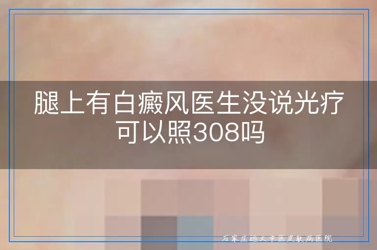 腿上有白癜风医生没说光疗可以照308吗