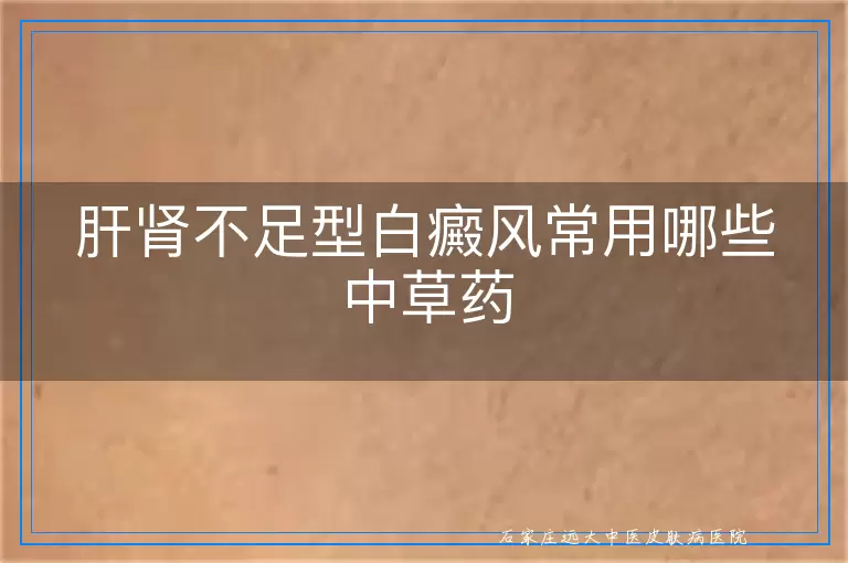 肝肾不足型白癜风常用哪些中草药