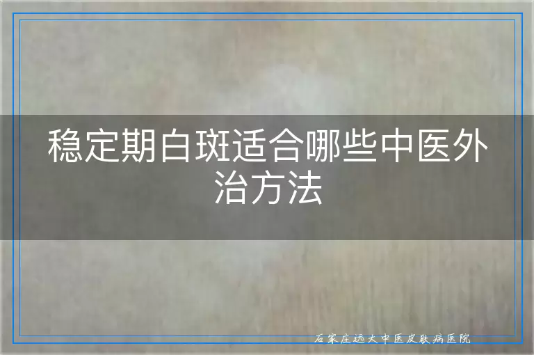 稳定期白斑适合哪些中医外治方法