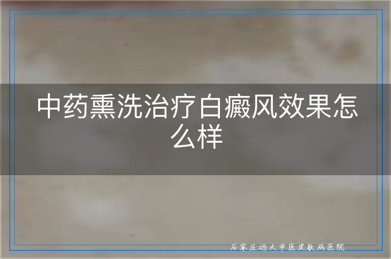 中药熏洗治疗白癜风效果怎么样