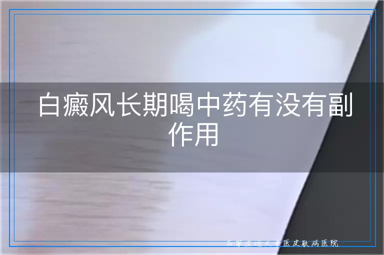白癜风长期喝中药有没有副作用
