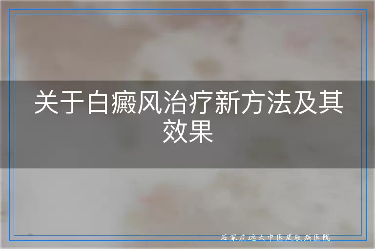 关于白癜风治疗新方法及其效果