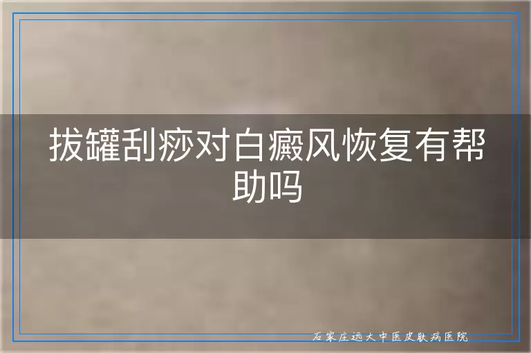 拔罐刮痧对白癜风恢复有帮助吗