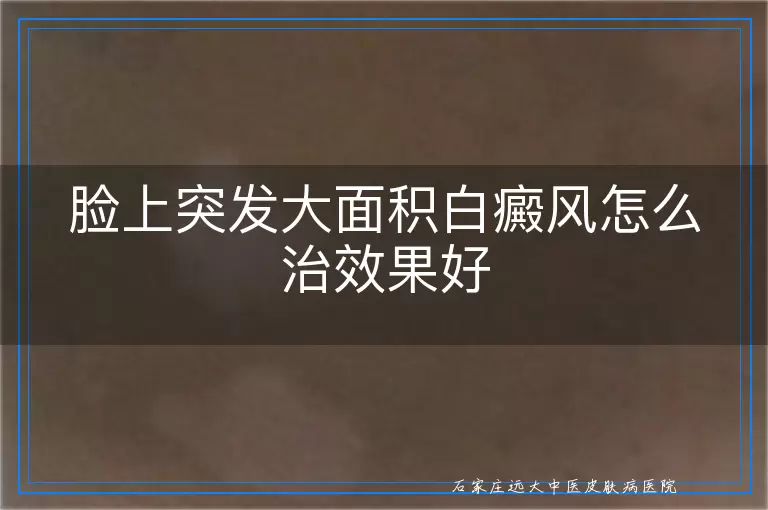 脸上突发大面积白癜风怎么治效果好