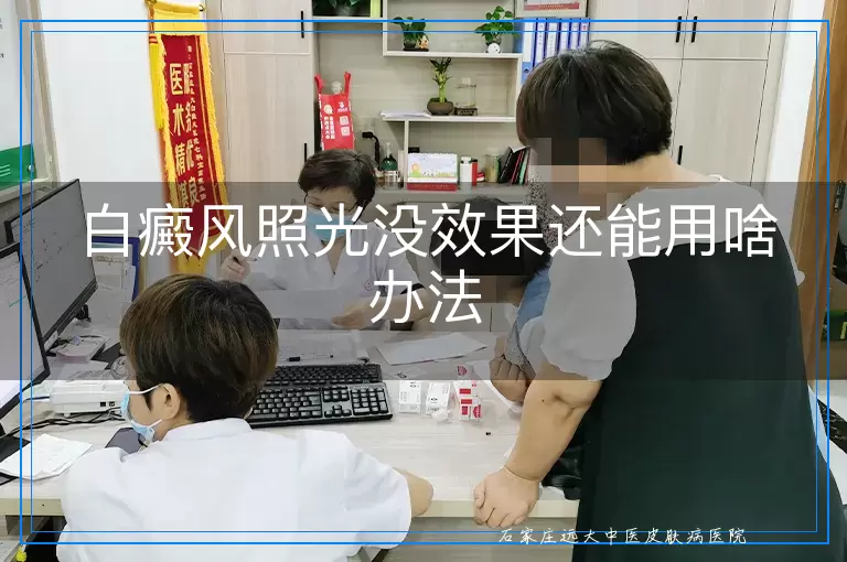 白癜风照光没效果还能用啥办法