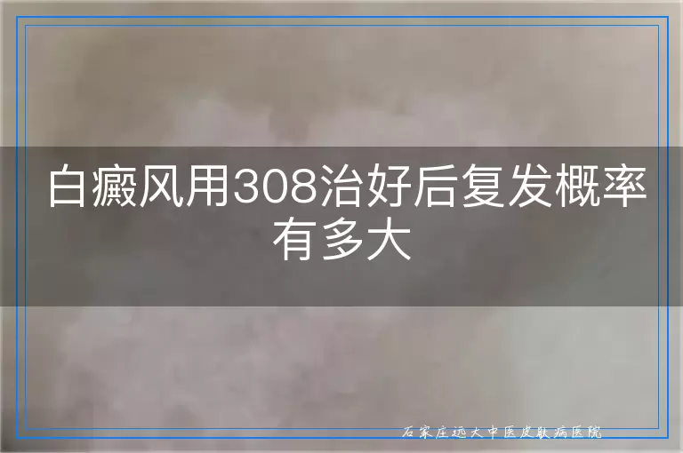 白癜风用308治好后复发概率有多大