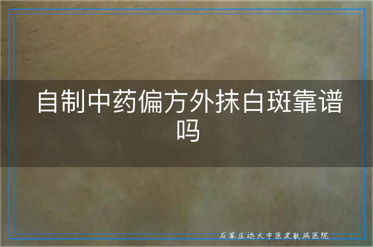 自制中药偏方外抹白斑靠谱吗