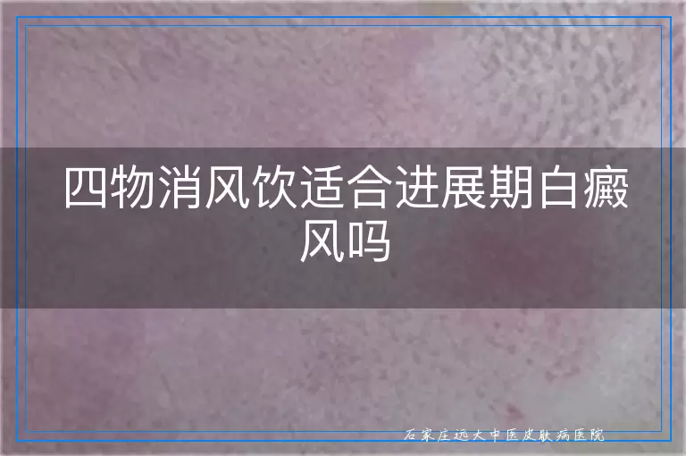 四物消风饮适合进展期白癜风吗