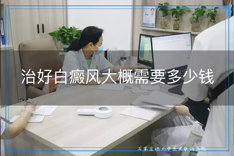 治好白癜风大概需要多少钱