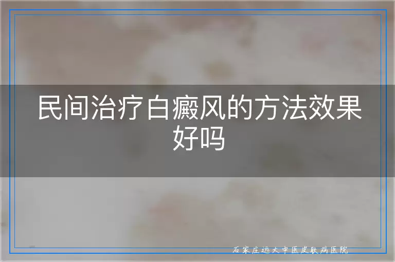 民间治疗白癜风的方法效果好吗