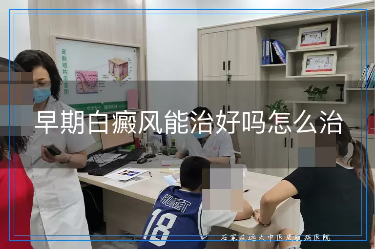 早期白癜风能治好吗怎么治
