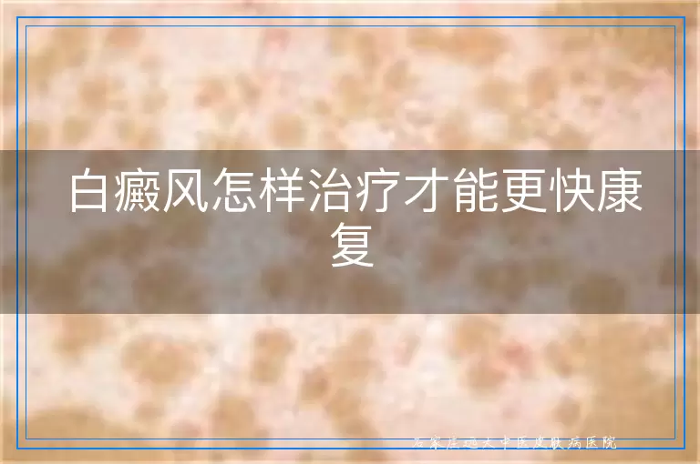 白癜风怎样治疗才能更快康复