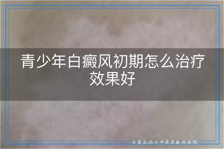 青少年白癜风初期怎么治疗效果好