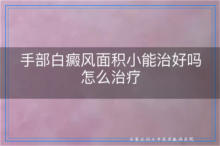 手部白癜风面积小能治好吗怎么治疗