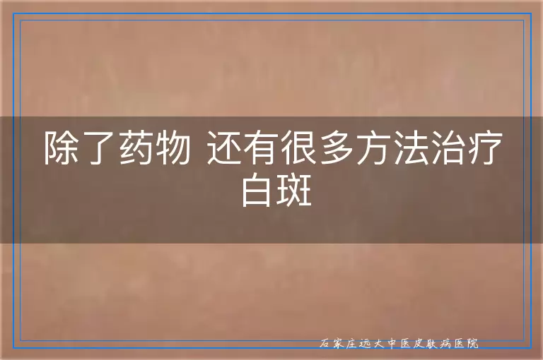除了药物 还有很多方法治疗白斑