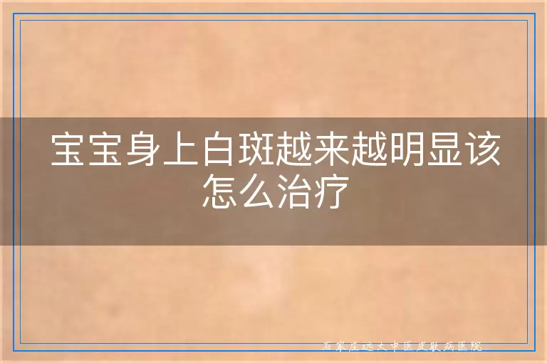 宝宝身上白斑越来越明显该怎么治疗