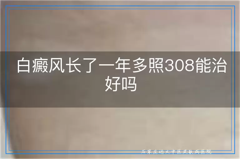 白癜风长了一年多照308能治好吗