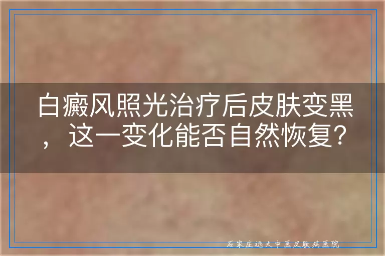 白癜风照光治疗后皮肤变黑，这一变化能否自然恢复？