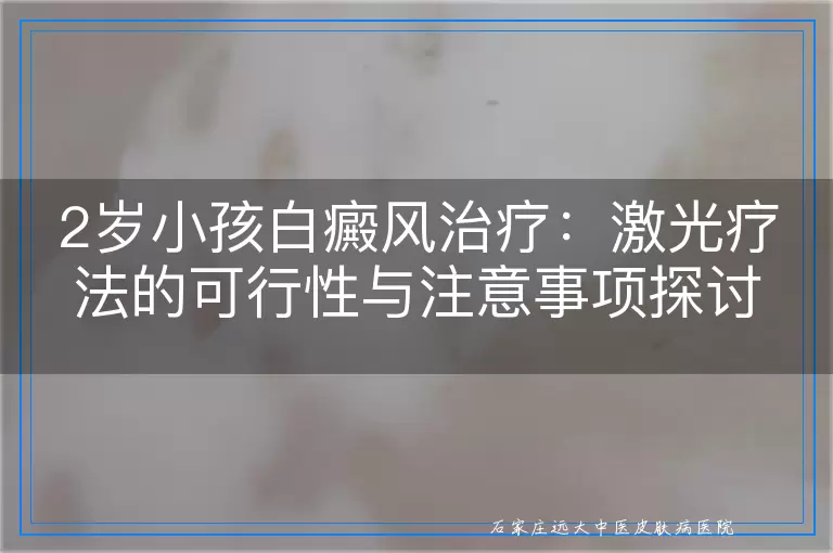 2岁小孩白癜风治疗：激光疗法的可行性与注意事项探讨