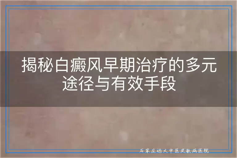 揭秘白癜风早期治疗的多元途径与有效手段