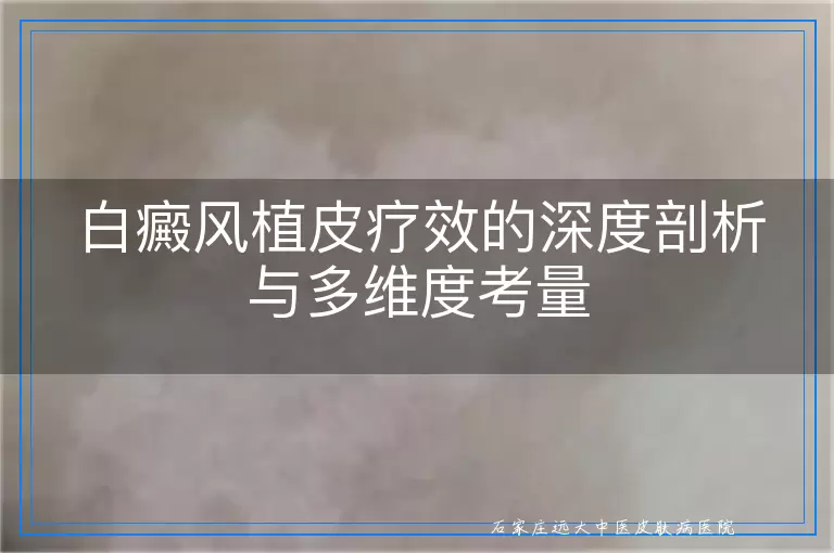 白癜风植皮疗效的深度剖析与多维度考量