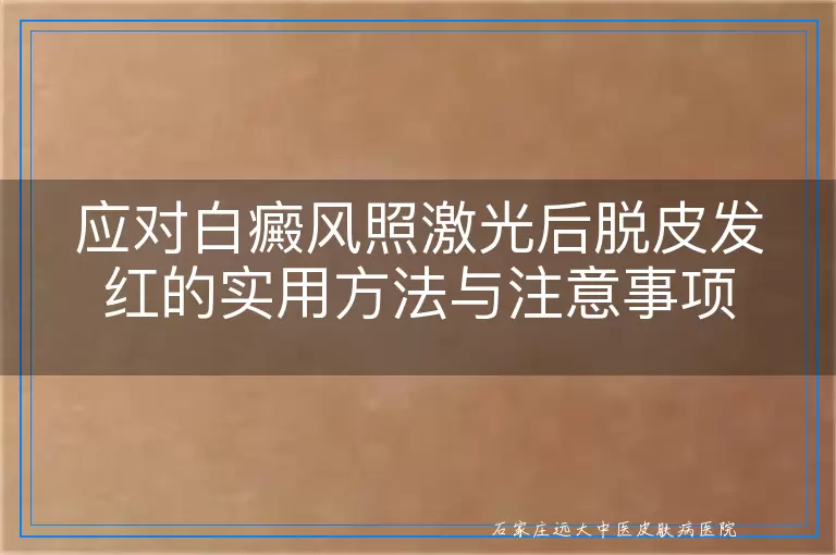 应对白癜风照激光后脱皮发红的实用方法与注意事项