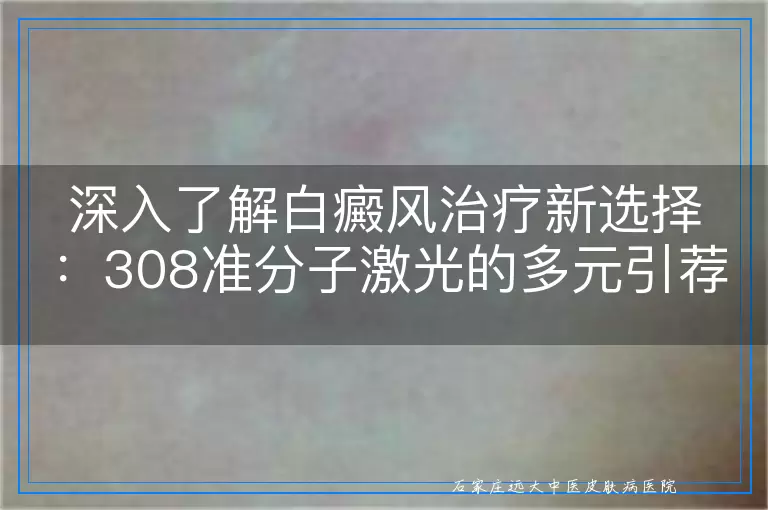 深入了解白癜风治疗新选择：308准分子激光的多元引荐与实际应用